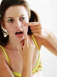 Acne vulgar é uma doença de pele que causa cravos e espinhas