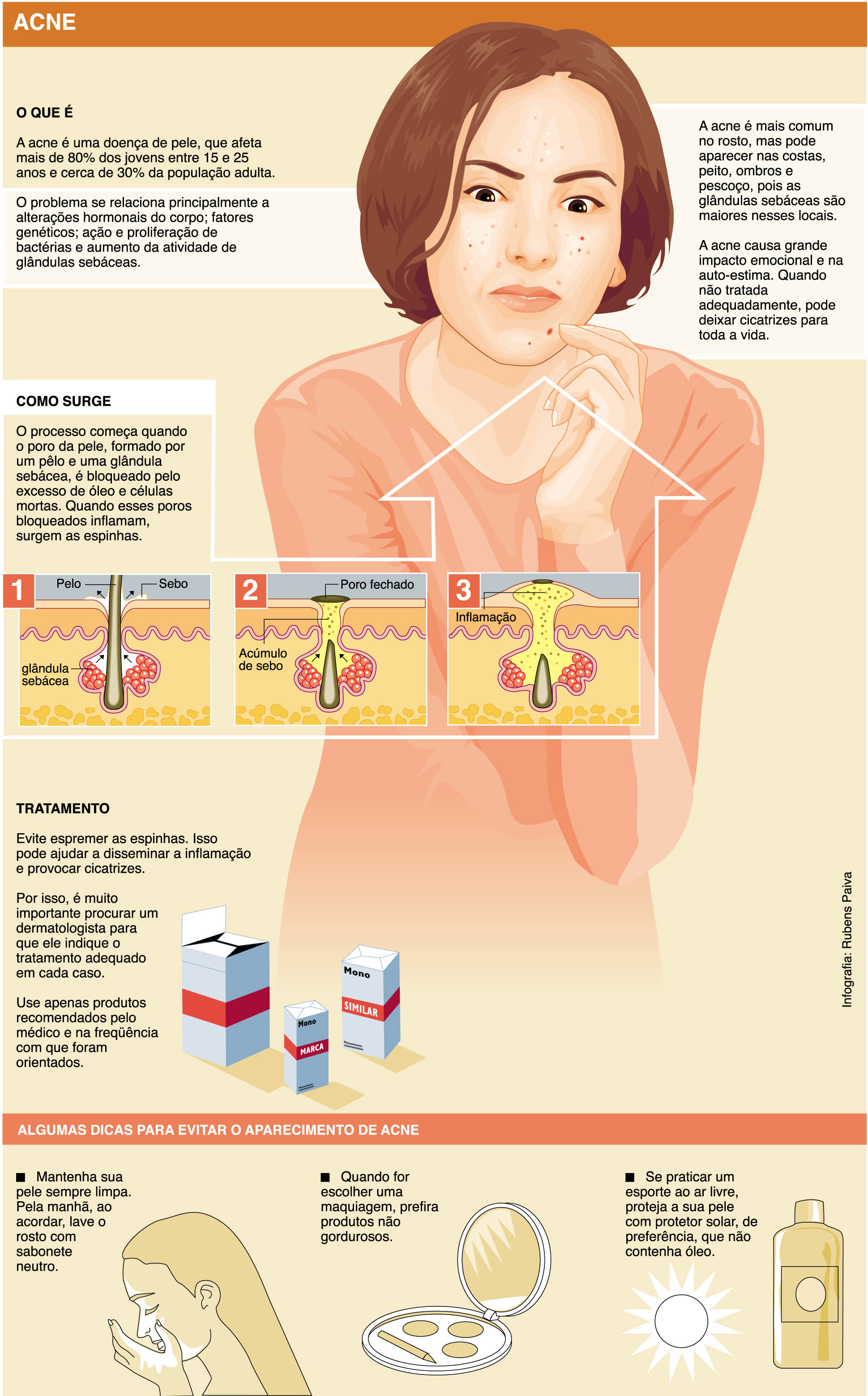 Espinhas e acne: entenda tudo sobre o assunto.