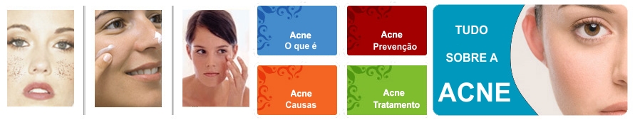 O que  Acne e espinhas? Saiba tudo sobre acne, cravos e espinhas. Tipos, causas, pomadas, medicamentos e tratamentos para acne.