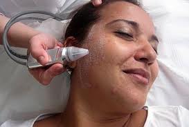 Tratamento acne. Uma limpeza de pele bem feita pode ajudar.